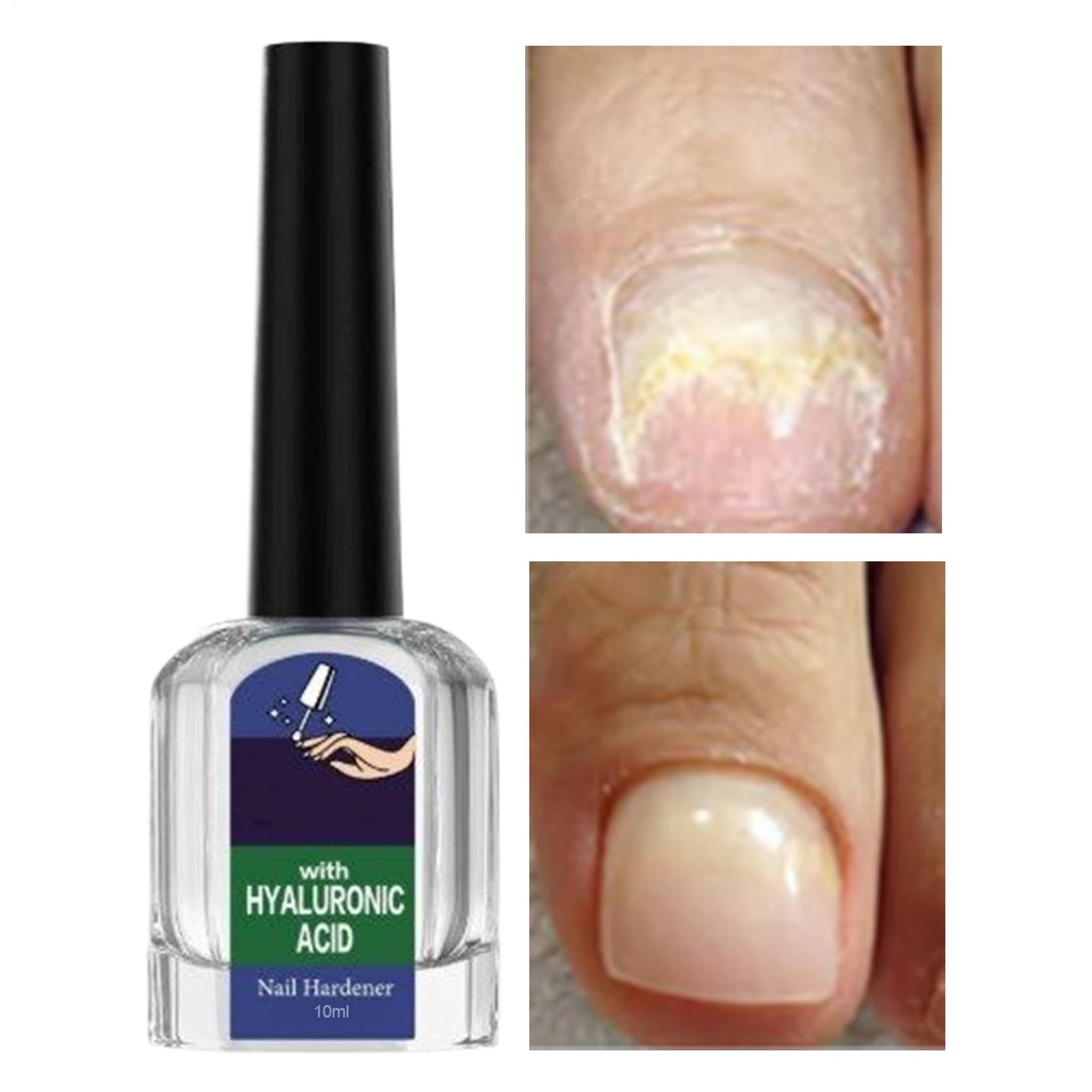 10ml Nail Strengthening Drops  – Home Gym In Apartment recenzja i cena